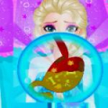 Elsa Abdominal Surgery